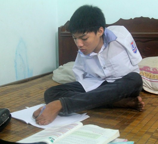 Cậu bé “chim cánh cụt” thực hiện giấc mơ tới giảng đường đại học