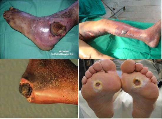 Liên tục khát nước - Hãy nghĩ ngay đến căn bệnh này