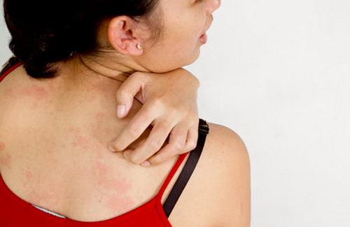 Những dấu hiệu cảnh báo gan nhiễm độc