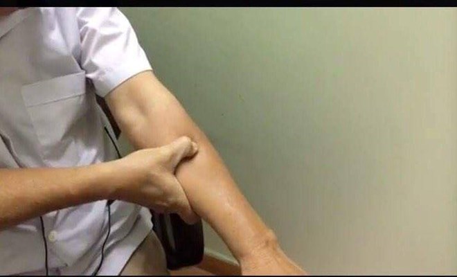 Cách trị ho không cần dùng thuốc kháng sinh 