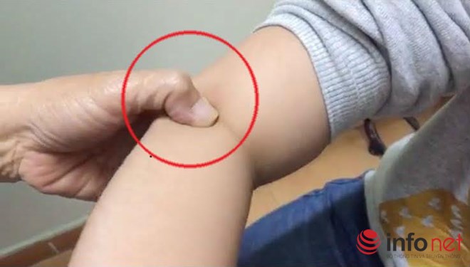 Cách trị ho không cần dùng thuốc kháng sinh 