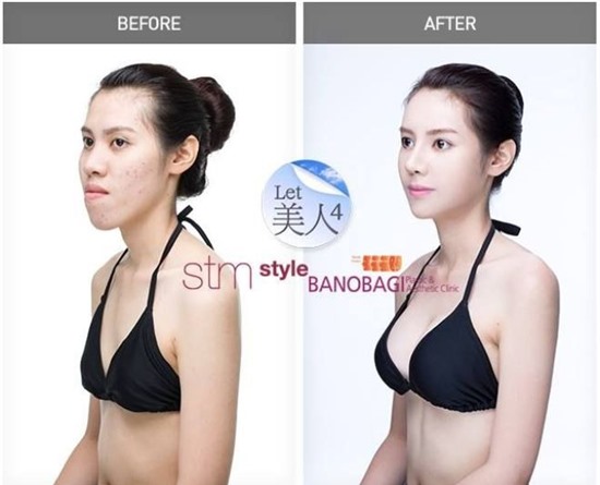 Phẫu thuật thẩm mỹ cùng những hệ lụy