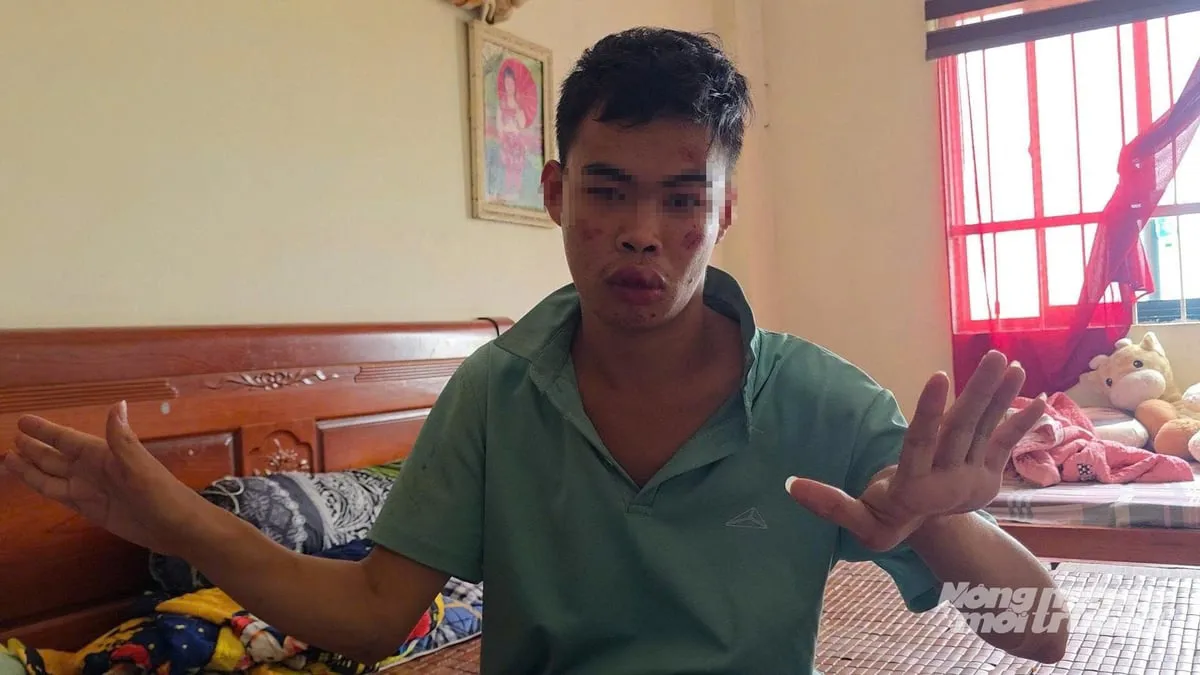 Người khuyết tật bị đánh đập, bảo vệ chung cư vẫn ngồi nhìn